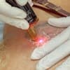 Забавные праздники - День сведения татуировки (Tattoo Removal Day)